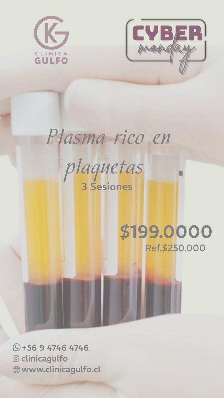 Cyber Monday 2025 - PRP